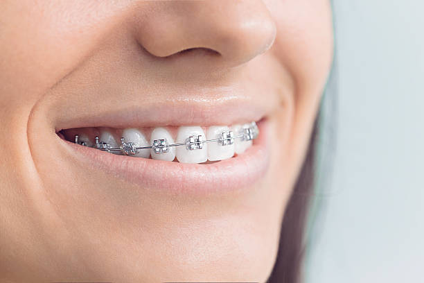 Best Traditional Braces  in Wood River, IL